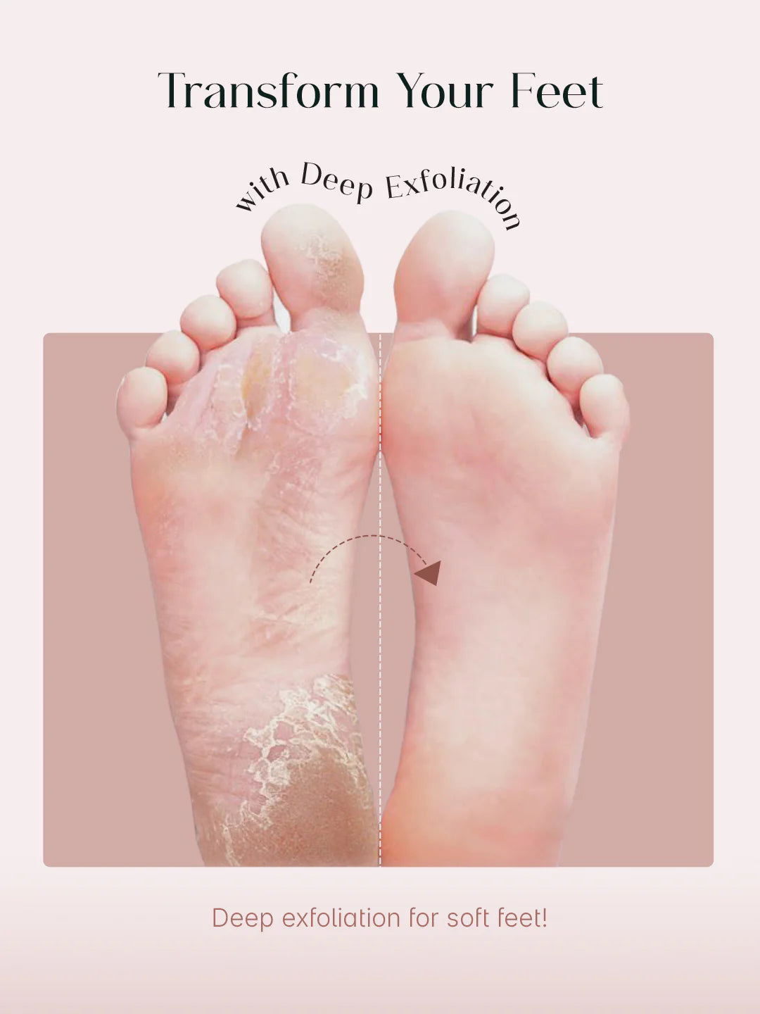 Exfoliating Foot Mask Hydrating Sock Pedicure Essential