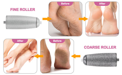 Callus remover
