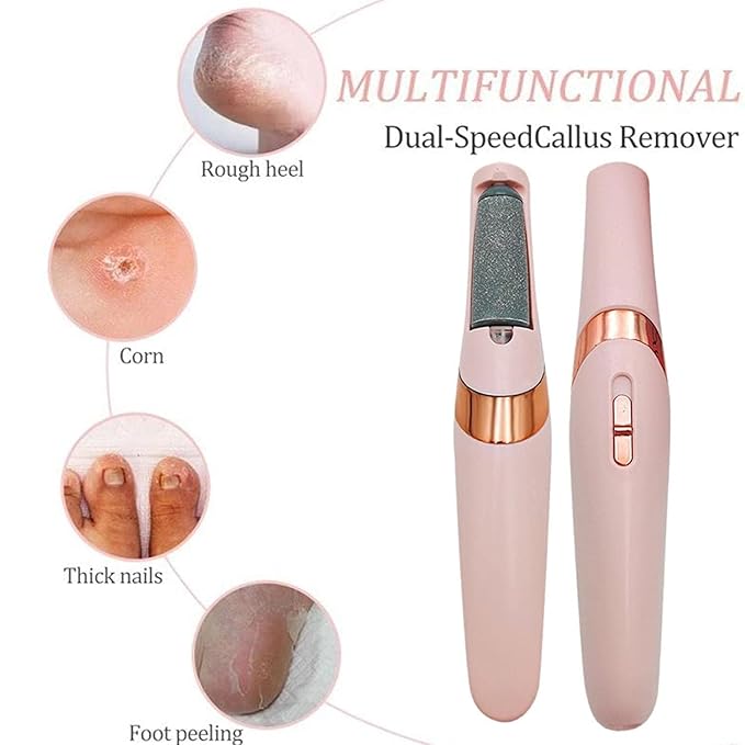 Callus remover
